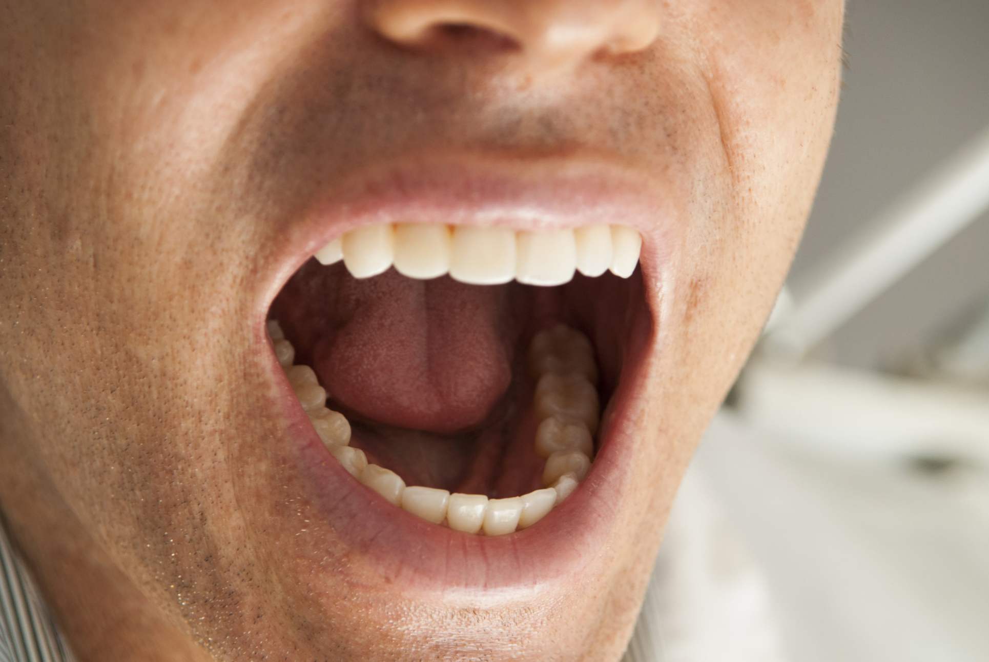 Сонник зуби - до чого сняться, тлумачення