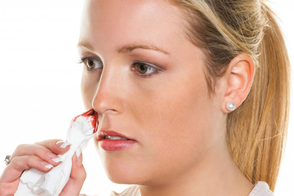 Krvácanie z nosa - spôsobuje u dospelých za normálnych podmienok.