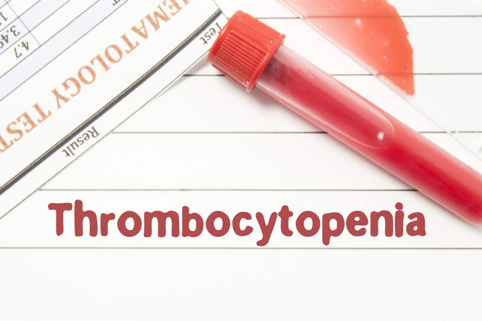 Trombocitopenija - kaj je to? Stopnja trombocitov v krvi žensk