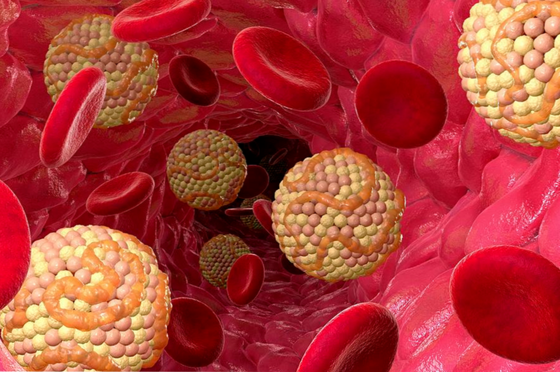 Kako znižati holesterol v krvi z zdravili in ljudskimi pravili
